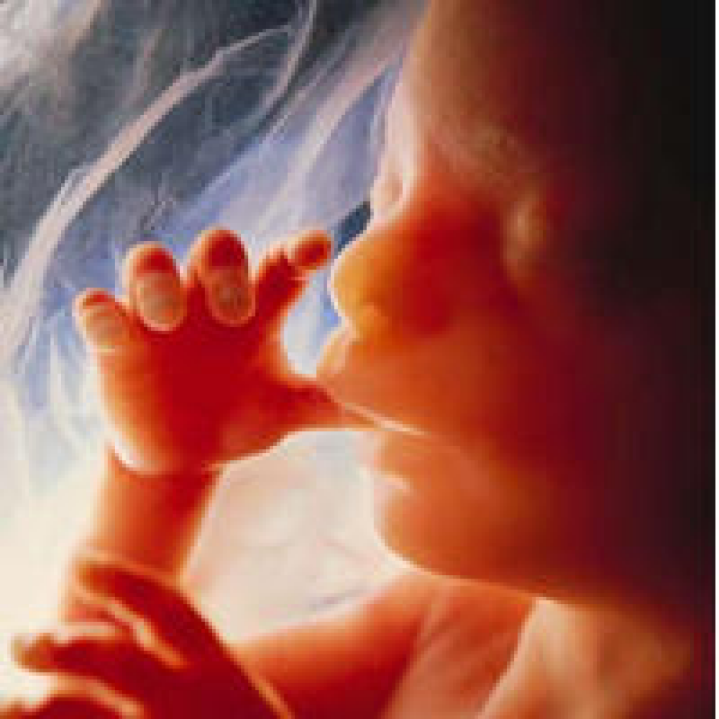 Fotos de aborto de un mes 94 Fotos de aborto de un mes 13