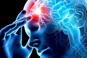 Лечение мигрени - МедПросвита