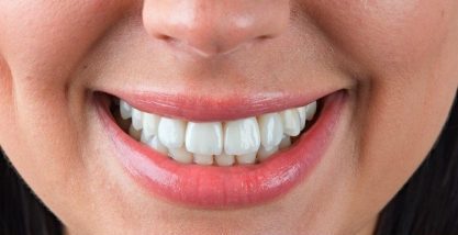 Зубні імпланти - МедПросвіта