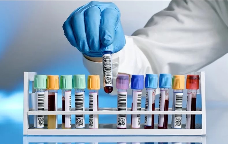 Лабораторні дослідження донорам крові