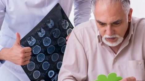 Медична допомога при деменції та легких когнітивних розладах — в Україні затвердили новий стандарт