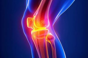 Електронна черга на ендопротезування: понад 19 тисяч операцій вже проведено пацієнтам